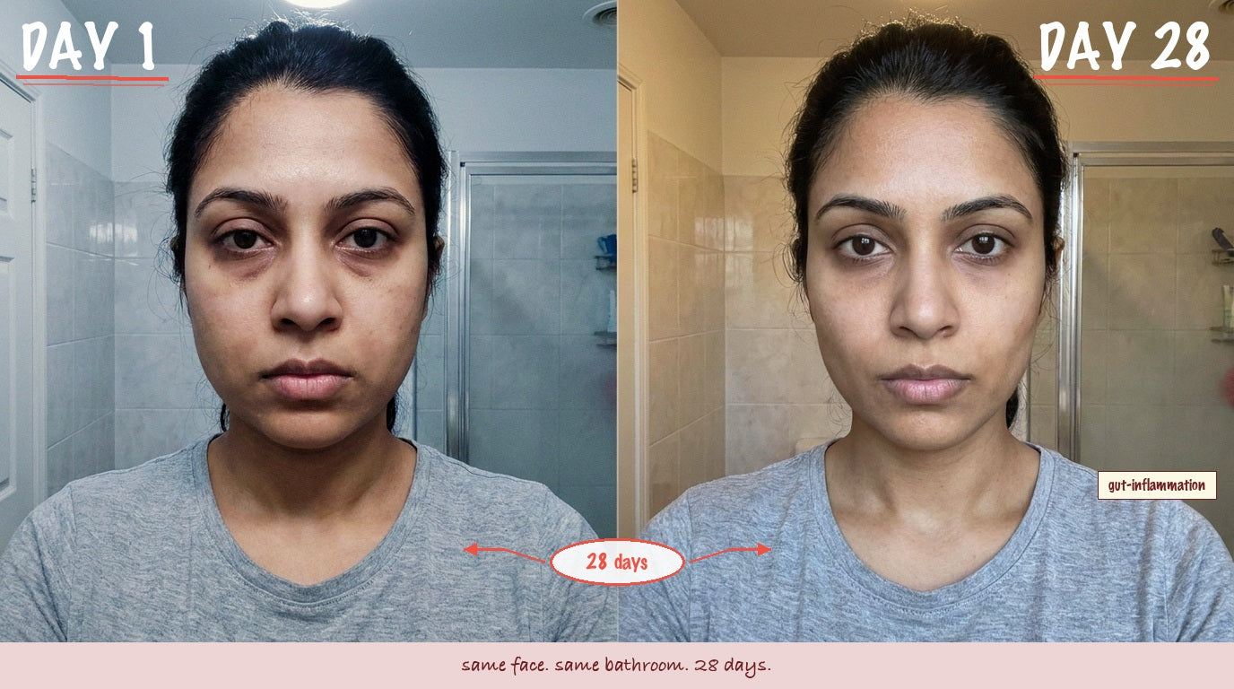 Day 1 to day 28: under-eye inflammation gone